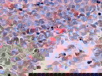 Mythe ontkracht: Stress zorgt niet voor kanker