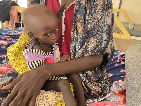 Ziekenhuizen Zuid-Soedan liggen vol met ondervoede kinderen uit Soedan