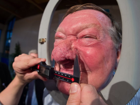 Hans heeft de grootste neus ter wereld en wil zijn titel verlengen