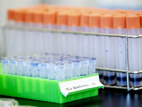 Aantal coronatesten in Nederland opgeschroefd