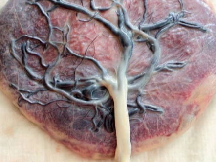 19:05 Gedicht: Placenta, van Lars Gustafsson