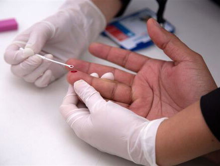 8:15 Aidsconferentie Amsterdam van start