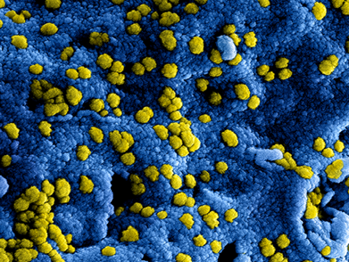 Nieuwe regionale coronamaatregelen