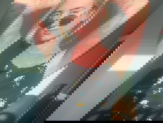 Debby (22) heeft psoriasis: "Best veel mensen hebben het, maar je ziet het niet altijd"