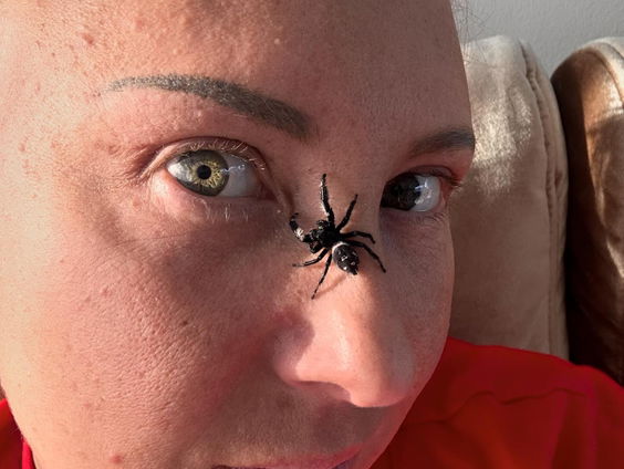 Amanda had een spinnenfobie, maar nu heeft ze er twee als huisdier