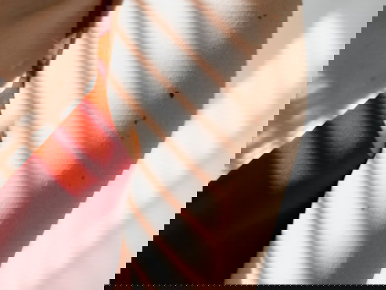 Shirley: "De dermatoloog pakte mijn arm en zei dat het er niet goed uit zag"