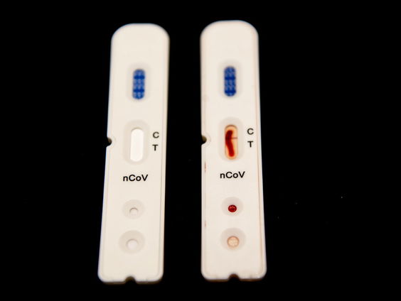 Meer bekend over impact long covid