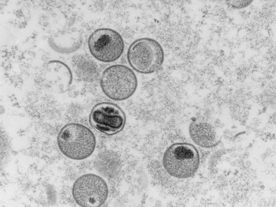 Apenpokken in Nederland