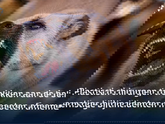 Plastisch chirurgen trekken aan de bel; jaarlijks minstens 70 mensen zwaar gewonden door hoogrisicohonden