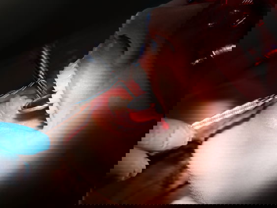 Motie tandarts terug in basispakket is verworpen