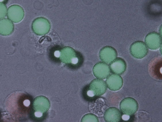 Wetenschappelijk onderzoek naar microvezels kan niet zonder burgers