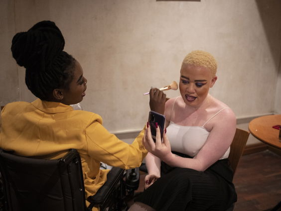 Internationale Dag van het Albinisme : "Het woord albino is eigenlijk beledigend"