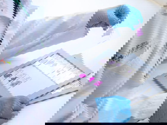 De Nederlandse Hersenbank ontving het 5000e brein