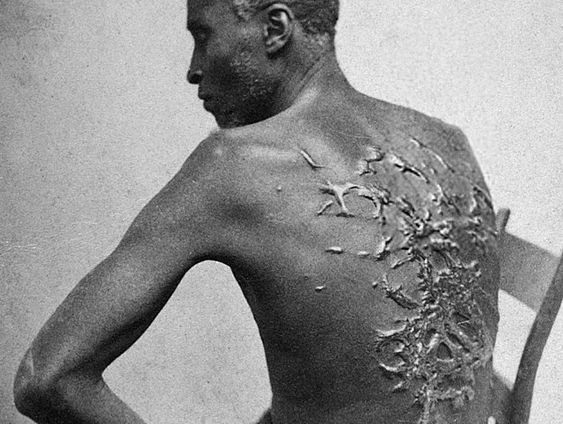 Whipped Peter, het verhaal achter de film ‘Emancipation’