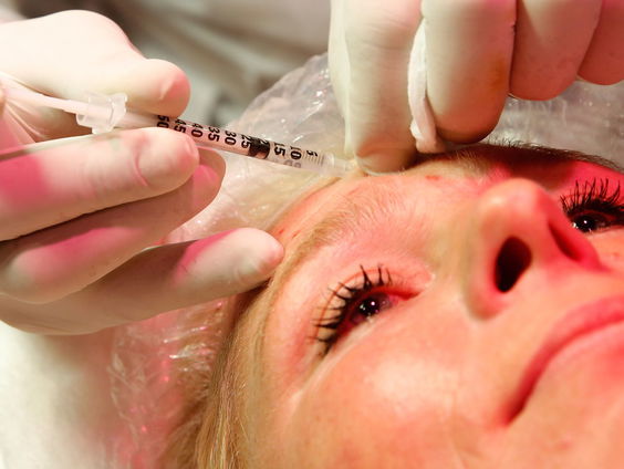 Roy Donders wil niet stoppen met het zetten van fillers, wat zijn de gevaren?