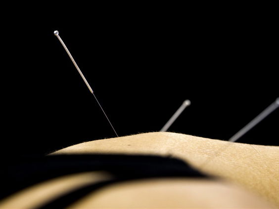 De WHO organiseert een top over traditionele geneeswijzen. Moeten we daar blij mee zijn?