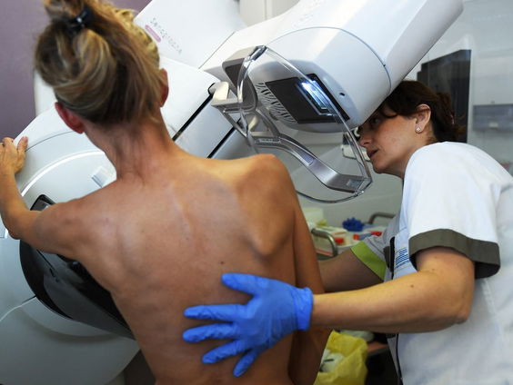 Echo kan wellicht pijnlijk onderzoek vervangen bij knobbeltje in borst