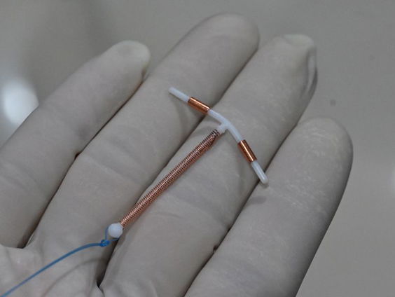 Natuurlijke anticonceptie steeds populairder, abortusklinieken zien daardoor stijging