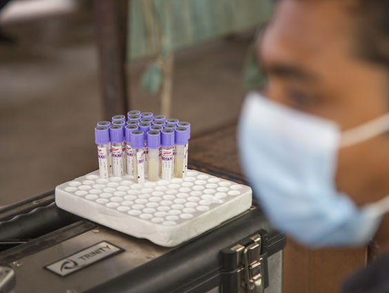 DNA-onderzoek naar tweeling in zedenzaak om dader aan te wijzen