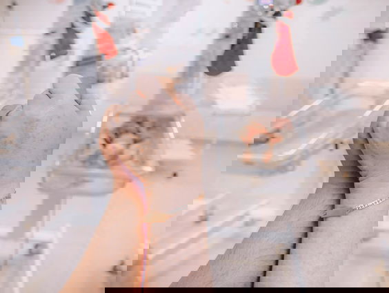 Extreme vroeggeboorte: is de grens van 24 weken te strikt in Nederland?