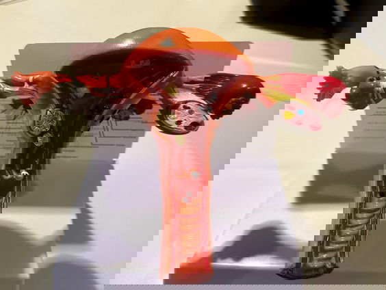 Endometriose: ‘Onzichtbare’ ziekte treft veel vrouwen