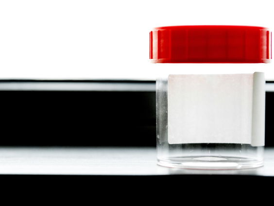 Prijzig zaad hier in Nederland, vindt dit D66-kamerlid