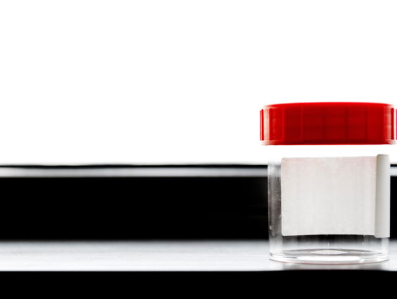 Kort geding tegen zaaddonor die vader is van honderden kinderen