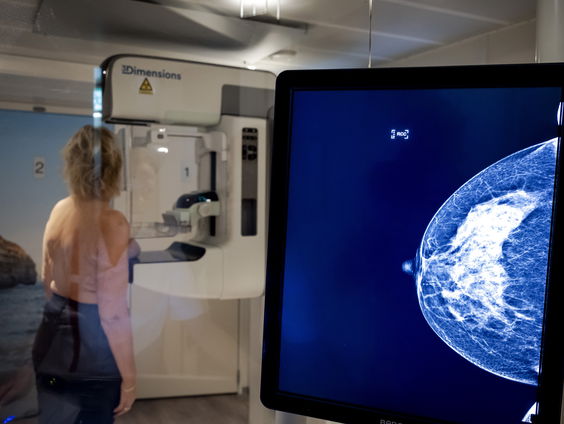 Toch geen foto's sturen na hersteloperaties borstkankerpatiënten