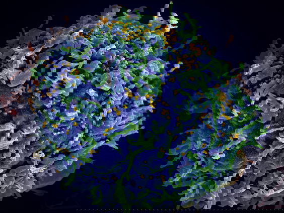 Zorg om gevluchte Oekraïners met hiv