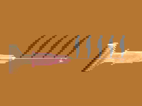 Geen tijd om te wachten op euthanasie