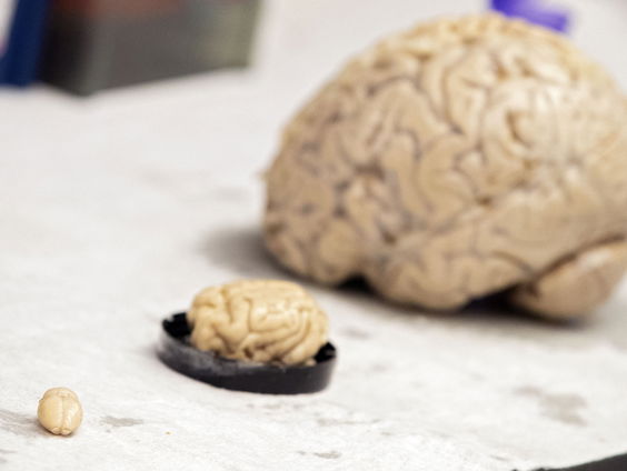 Waarom zijn de hersenen van de mens zo groot?