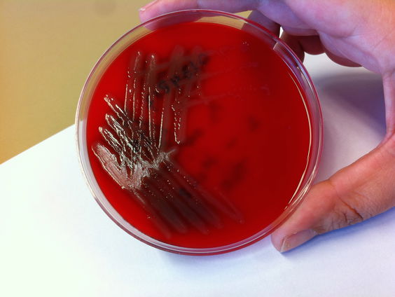 Wat als antibiotica niet meer werkt?