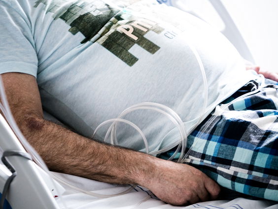 'Patiënten wachten in ziekenhuis vier keer langer op uitgestelde zorg dan in privékliniek'