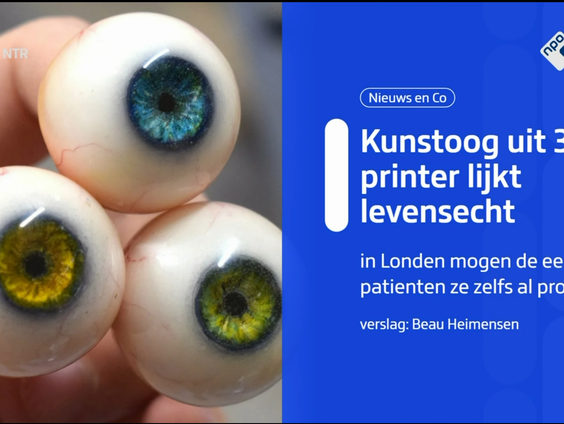 Oogprothese printen met een 3D printer