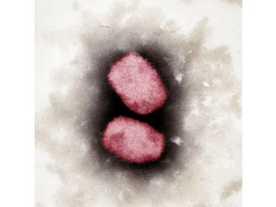 Moet er preventief gevaccineerd worden tegen apenpokken?