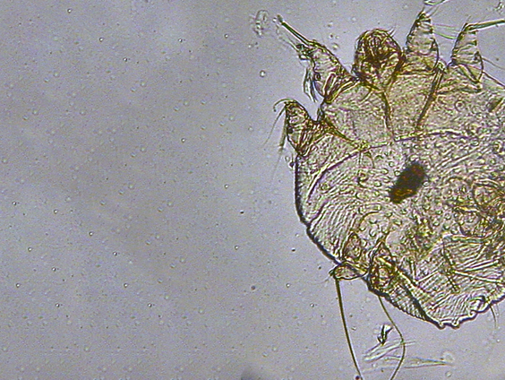 Studenten worden massaal geteisterd door de schurftmijt