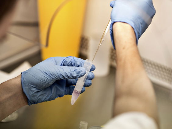 Brabantse gynaecoloog gebruikte eigen zaad voor verwekken donorkinderen