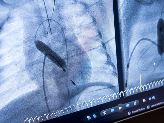 Statushouders verkleinen versneld personeelstekort in hartzorg