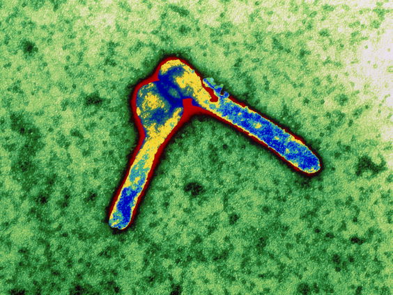 9 mensen overleden in Equatoriaal-Guinea door Malburgvirus