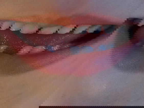 Sjoerd (10) doneert geld van de tandenfee aan Giro555