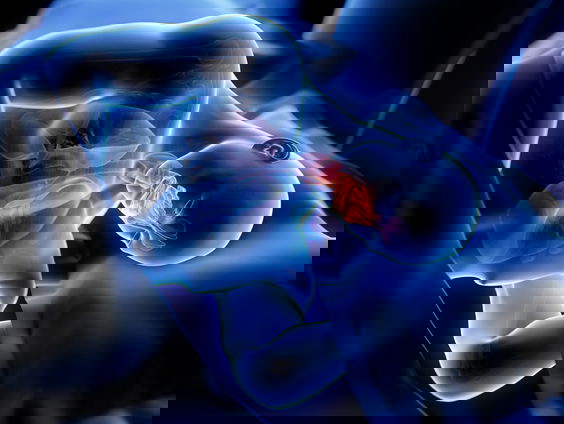 De dromenvanger, nr. 352: "Apneu"