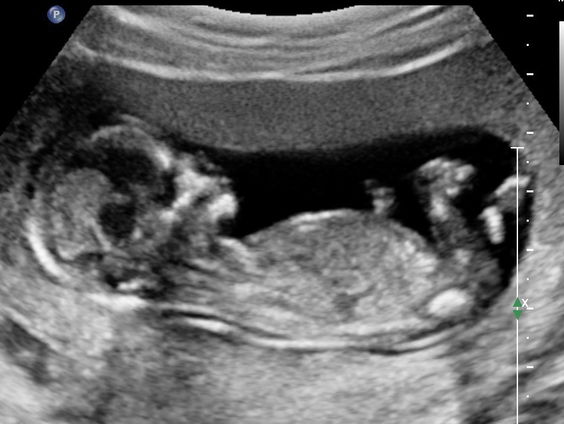 De dromenvanger, nr. 323