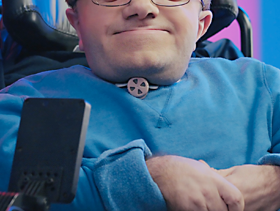 Museumtip: (On)beperkt. Leven met een handicap