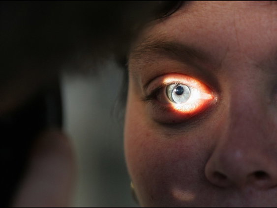 Meisje van 11 bedenkt iPhone-app genaamd Ogler Eyescan voor oogziekten