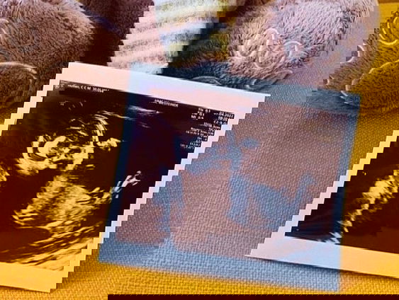 Chantal is in verwachting!