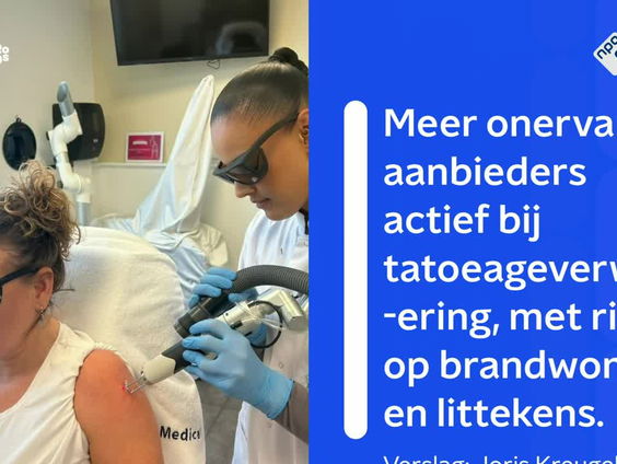 Meer onervaren aanbieders actief bij tatoeageverwijdering